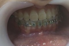 pre-op-view